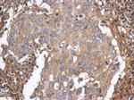 ST3GAL5 Antibody in Immunohistochemistry (Paraffin) (IHC (P))