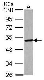 ST3GAL5 Antibody in Western Blot (WB)