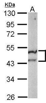 ST3GAL5 Antibody in Western Blot (WB)