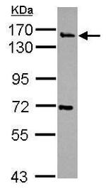 Synaptojanin 2 Antibody in Western Blot (WB)