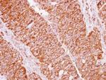 eIF2 beta Antibody in Immunohistochemistry (Paraffin) (IHC (P))