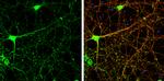 USP14 Antibody in Immunocytochemistry (ICC/IF)