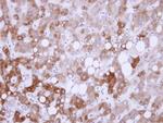 USP14 Antibody in Immunohistochemistry (Paraffin) (IHC (P))