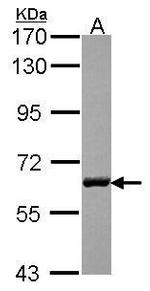 USP14 Antibody in Western Blot (WB)