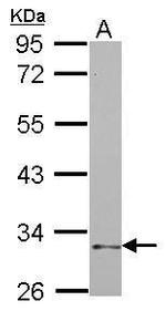 NKp46 Antibody in Western Blot (WB)