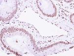 VPS4B Antibody in Immunohistochemistry (Paraffin) (IHC (P))