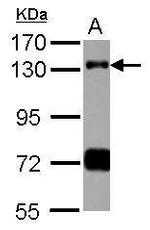 RNF40 Antibody in Western Blot (WB)