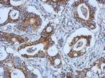 KIAA0196 Antibody in Immunohistochemistry (Paraffin) (IHC (P))