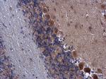 FARSB Antibody in Immunohistochemistry (Paraffin) (IHC (P))