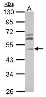 Arp3 Antibody in Western Blot (WB)