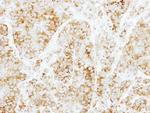 Syntaxin 6 Antibody in Immunohistochemistry (Paraffin) (IHC (P))