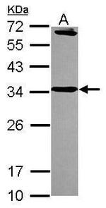 Syntaxin 6 Antibody in Western Blot (WB)