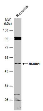 NMUR1 Antibody in Western Blot (WB)