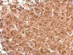 IFITM3 Antibody in Immunohistochemistry (Paraffin) (IHC (P))