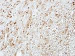 PRMT5 Antibody in Immunohistochemistry (Paraffin) (IHC (P))