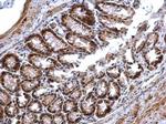 PRMT5 Antibody in Immunohistochemistry (Paraffin) (IHC (P))