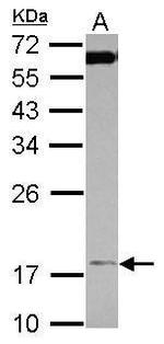 TIM17 Antibody in Western Blot (WB)