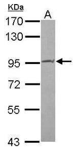 PIBF1 Antibody in Western Blot (WB)