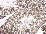 RGS14 Antibody in Immunohistochemistry (Paraffin) (IHC (P))