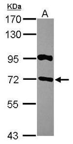 RGS14 Antibody in Western Blot (WB)