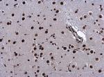 HP1 beta Antibody in Immunohistochemistry (Paraffin) (IHC (P))