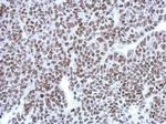 HP1 beta Antibody in Immunohistochemistry (Paraffin) (IHC (P))