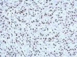 HP1 beta Antibody in Immunohistochemistry (Paraffin) (IHC (P))