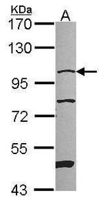 NAA15 Antibody in Western Blot (WB)