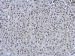 PRDM4 Antibody in Immunohistochemistry (Paraffin) (IHC (P))