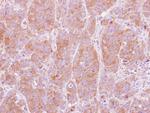 NT5C2 Antibody in Immunohistochemistry (Paraffin) (IHC (P))