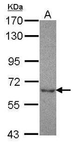 NT5C2 Antibody in Western Blot (WB)