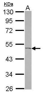 ACOT9 Antibody in Western Blot (WB)