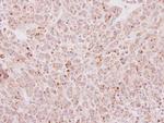 EDC4 Antibody in Immunohistochemistry (Paraffin) (IHC (P))