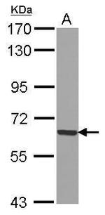 GADD34 Antibody in Western Blot (WB)