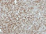 KIF4A Antibody in Immunohistochemistry (Paraffin) (IHC (P))