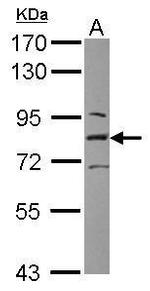 L3MBTL1 Antibody in Western Blot (WB)