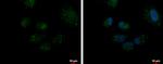 DECR2 Antibody in Immunocytochemistry (ICC/IF)