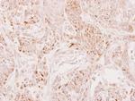 DECR2 Antibody in Immunohistochemistry (Paraffin) (IHC (P))