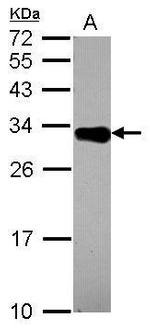 DECR2 Antibody in Western Blot (WB)