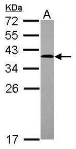 LDLRAP1 Antibody in Western Blot (WB)