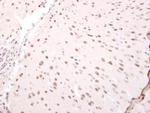 NARF Antibody in Immunohistochemistry (Paraffin) (IHC (P))