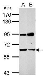 NARF Antibody in Western Blot (WB)