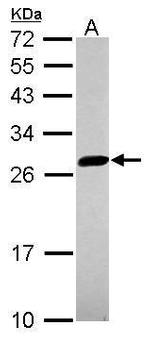 UBE2S Antibody in Western Blot (WB)