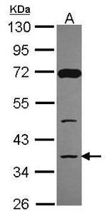 DCPS Antibody in Western Blot (WB)