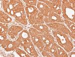 CTNNA3 Antibody in Immunohistochemistry (Paraffin) (IHC (P))