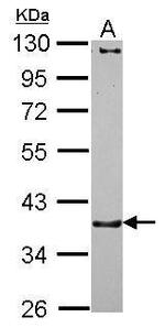 CTNNA3 Antibody in Western Blot (WB)