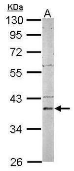 PSAT1 Antibody in Western Blot (WB)