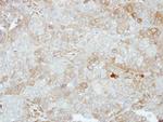 VPS28 Antibody in Immunohistochemistry (Paraffin) (IHC (P))