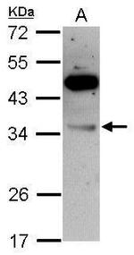 VPS28 Antibody in Western Blot (WB)