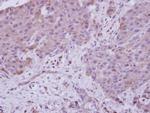 NAA15 Antibody in Immunohistochemistry (Paraffin) (IHC (P))